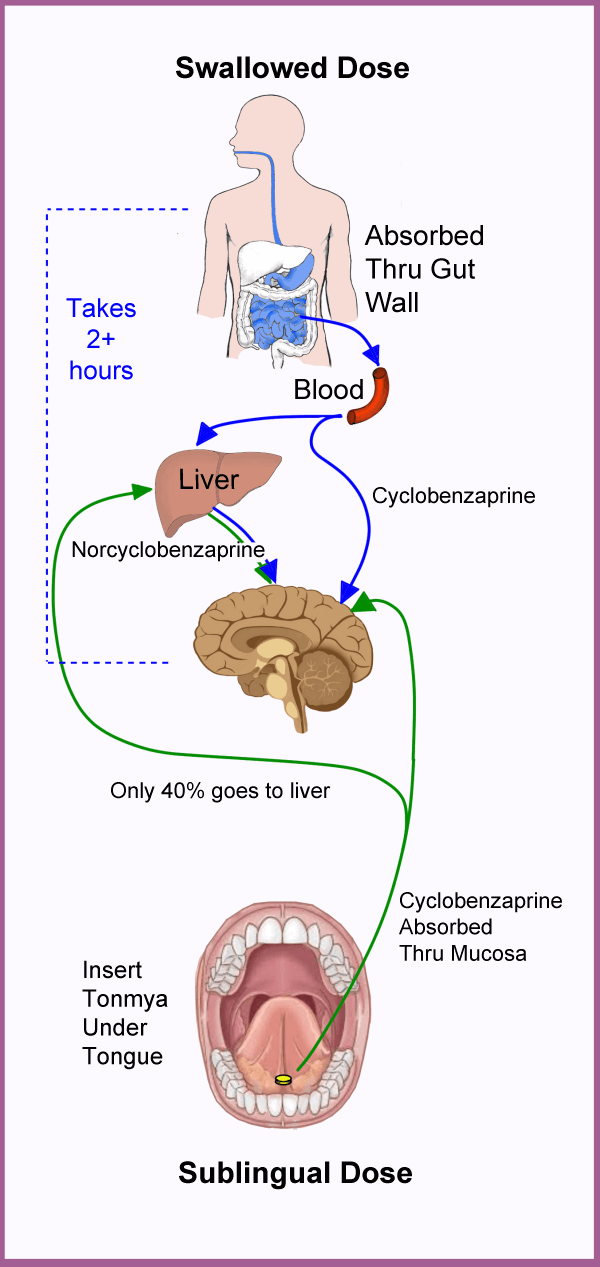 Diagram showing the difference between swallowed cyclobenzaprine versus Tonmya (sublingual cyclobenzaprine), a potential new medication for fibromyalgia.