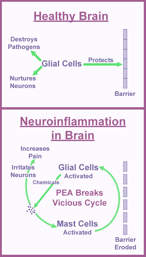 Diagram shows how the OTC supplement, palmitoylethanolamide (PEA), works to reduce neuroinflammation in fibromyalgia patients.